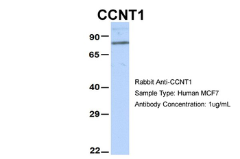 CCNT1 Rabbit Polyclonal Antibody