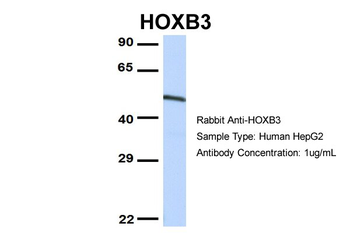 CCNT1 Rabbit Polyclonal Antibody