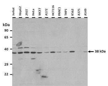 CCNH Rabbit Polyclonal Antibody