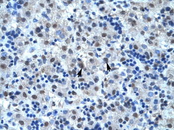 CDC25B Rabbit Polyclonal Antibody