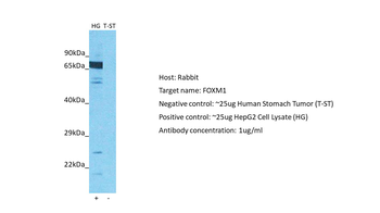 FOXM1 Rabbit Polyclonal Antibody