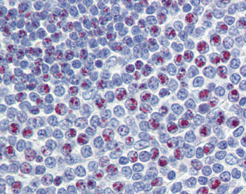 FOXM1 Rabbit Polyclonal Antibody