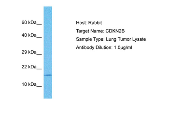 CDKN2B Rabbit Polyclonal Antibody