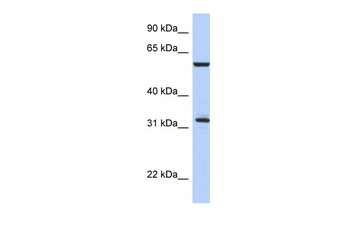 CDC34 Rabbit Polyclonal Antibody