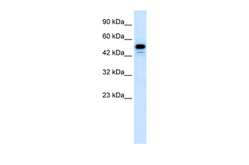 CDK8 Rabbit Polyclonal Antibody