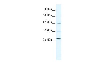 E2F1 Rabbit Polyclonal Antibody
