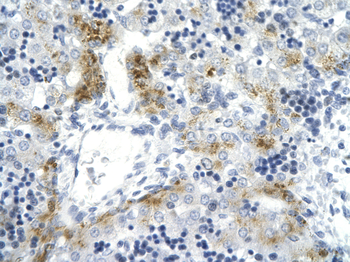 TOP2A Rabbit Polyclonal Antibody