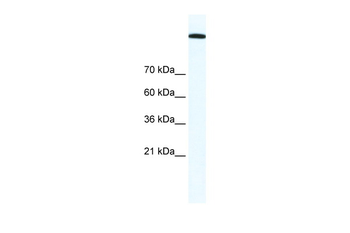 TOP2A Rabbit Polyclonal Antibody