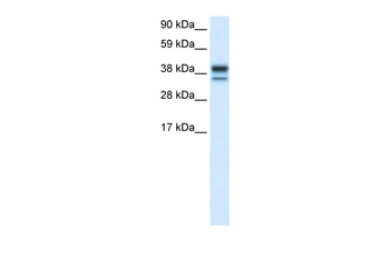 MAPK14 Rabbit Polyclonal Antibody