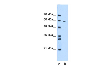 MDM4 Rabbit Polyclonal Antibody