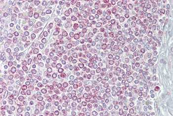 CXCL14 Rabbit Polyclonal Antibody