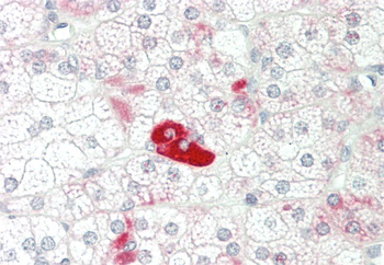 CCL8 Rabbit Polyclonal Antibody