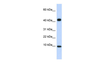 CCL8 Rabbit Polyclonal Antibody