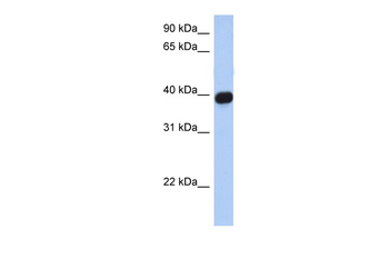 CXCR6 Rabbit Polyclonal Antibody