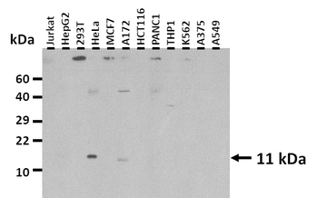 CXCL3 Rabbit Polyclonal Antibody