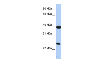 GPR15 Rabbit Polyclonal Antibody