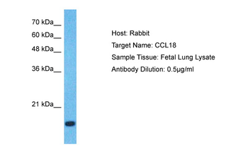CCL18 Rabbit Polyclonal Antibody