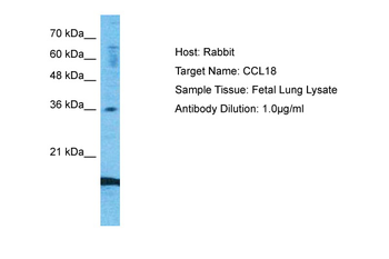 CCL18 Rabbit Polyclonal Antibody