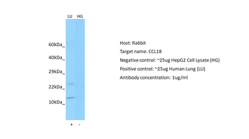 CCL18 Rabbit Polyclonal Antibody
