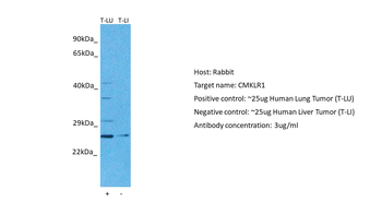 CMKLR1 Rabbit Polyclonal Antibody
