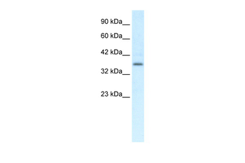 CMKLR1 Rabbit Polyclonal Antibody