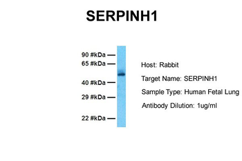 SERPINH1 Rabbit Polyclonal Antibody