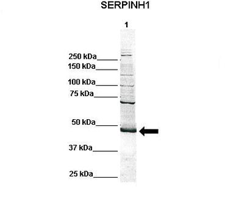 SERPINH1 Rabbit Polyclonal Antibody