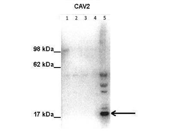 CAV2 Rabbit Polyclonal Antibody