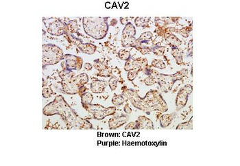 CAV2 Rabbit Polyclonal Antibody