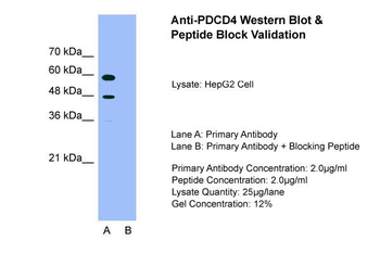 PDCD4 Rabbit Polyclonal Antibody
