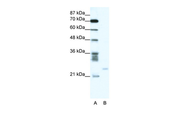 BCL2A1 Rabbit Polyclonal Antibody