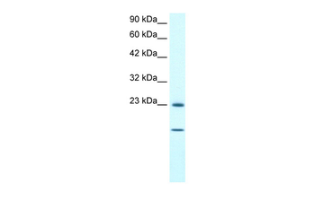 HSPB1 Rabbit Polyclonal Antibody