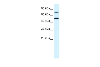 CHML Rabbit Polyclonal Antibody