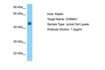 CHRNA7 Rabbit Polyclonal Antibody