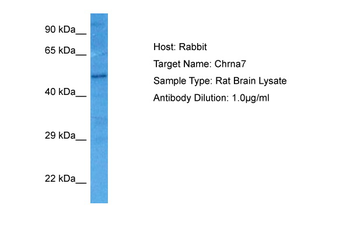 CHRNA7 Rabbit Polyclonal Antibody