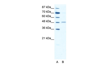 GABRA2 Rabbit Polyclonal Antibody