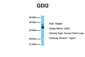 GDI2 Rabbit Polyclonal Antibody