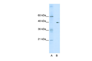 GDI2 Rabbit Polyclonal Antibody