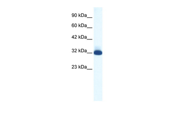 HTR1B Rabbit Polyclonal Antibody