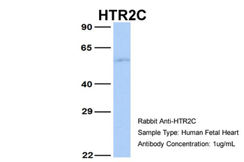 HTR2C Rabbit Polyclonal Antibody