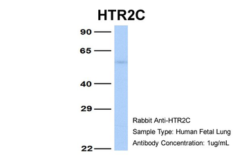 HTR2C Rabbit Polyclonal Antibody