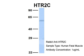 HTR2C Rabbit Polyclonal Antibody