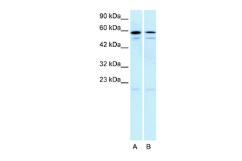 HTR2C Rabbit Polyclonal Antibody