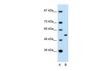 APBA1 Rabbit Polyclonal Antibody