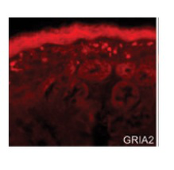 GRIA2 Rabbit Polyclonal Antibody