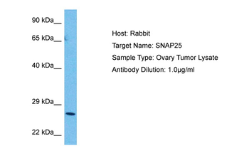 SNAP25 Rabbit Polyclonal Antibody