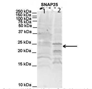 SNAP25 Rabbit Polyclonal Antibody