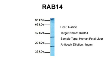 RAB14 Rabbit Polyclonal Antibody