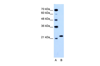 RAB14 Rabbit Polyclonal Antibody