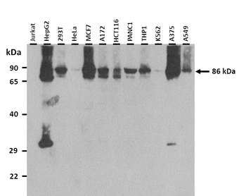 CTNNB1 Rabbit Polyclonal Antibody